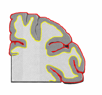 大脳皮質-min